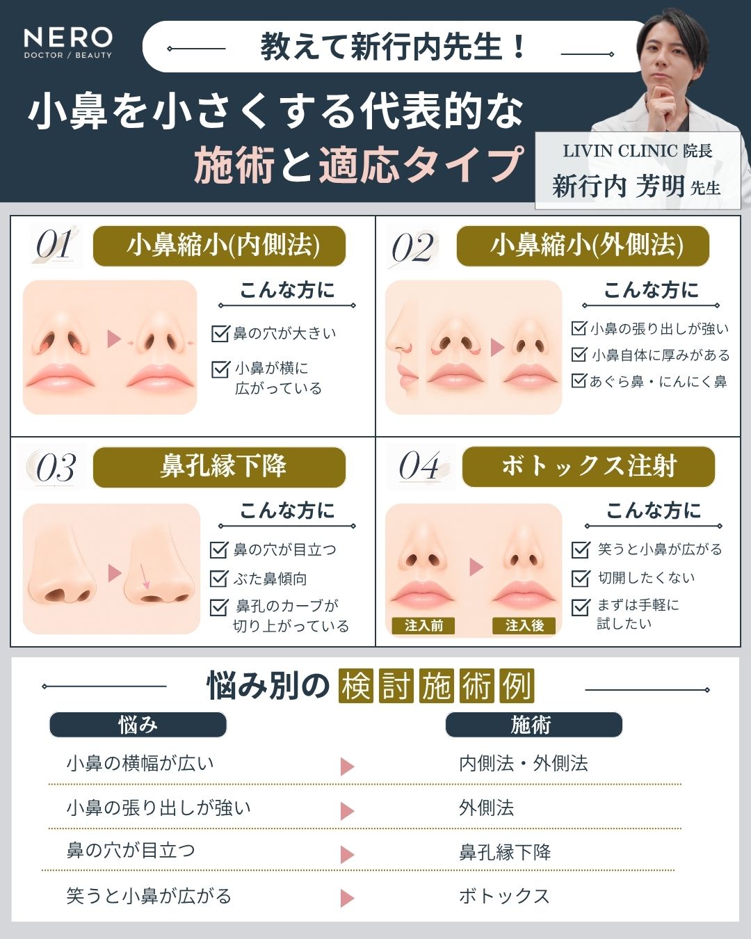 小鼻を小さくする代表的な施術と適応タイプを解説