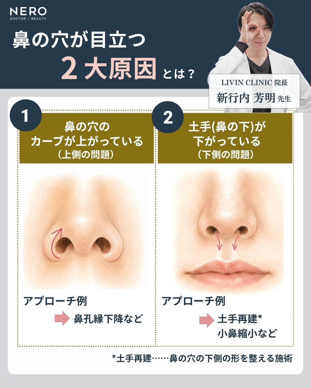 鼻の穴が目立つ2大原因解説