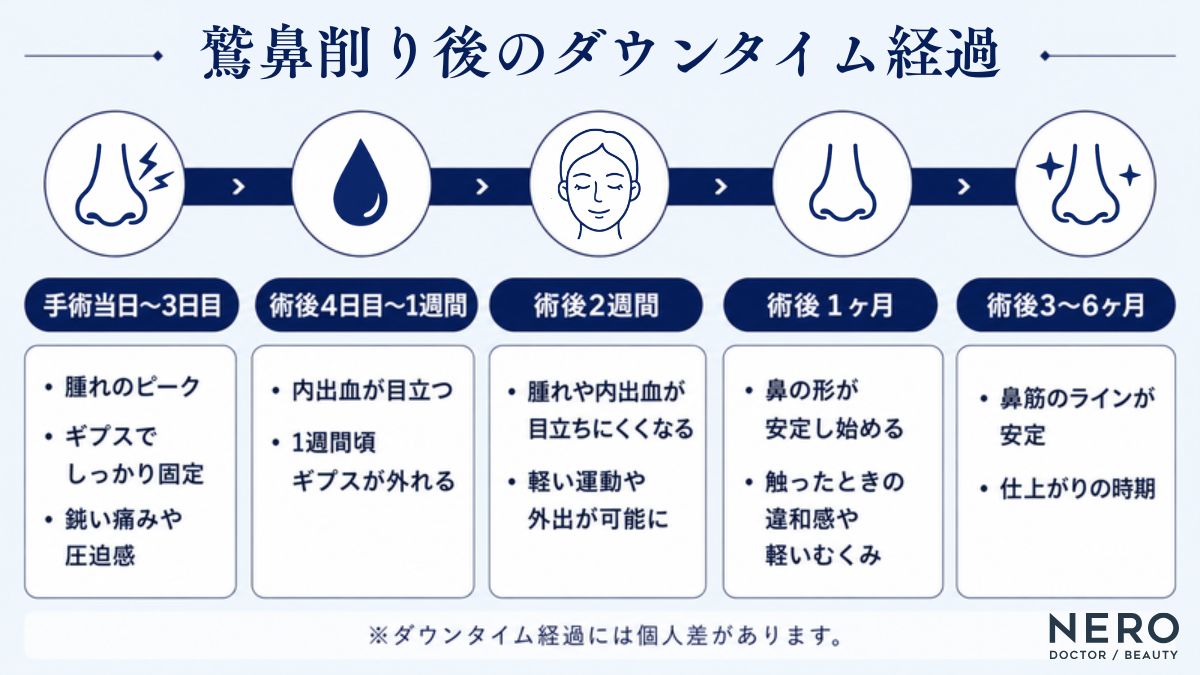 鷲鼻削りのダウンタイム経過を時系列でまとめた図