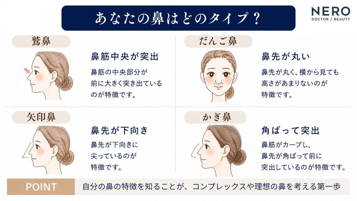 鷲鼻とほかの鼻の特徴を比較した一覧表