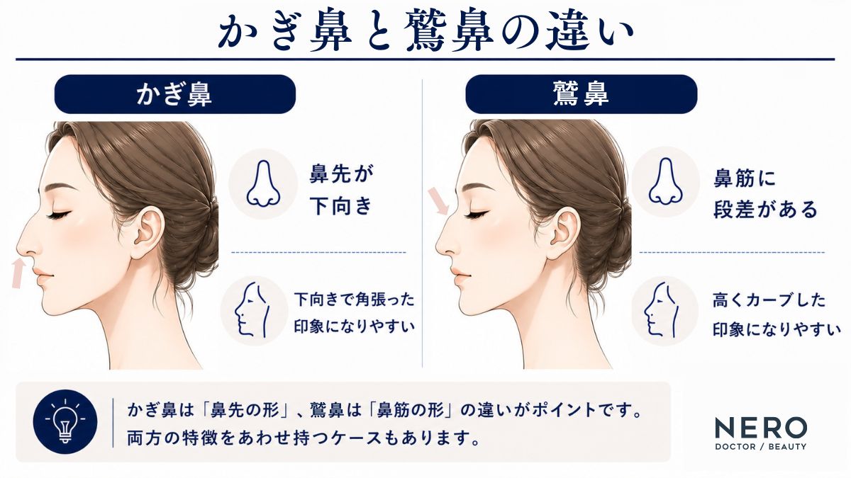 かぎ鼻と鷲鼻の特徴の違いを比較した表