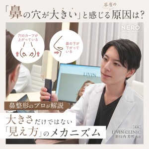 鼻の穴が大きいと感じる本当の原因は？大きさだけではない「見え方」のメカニズムを鼻整形のプロが解説【LIVIN CLINIC監修】