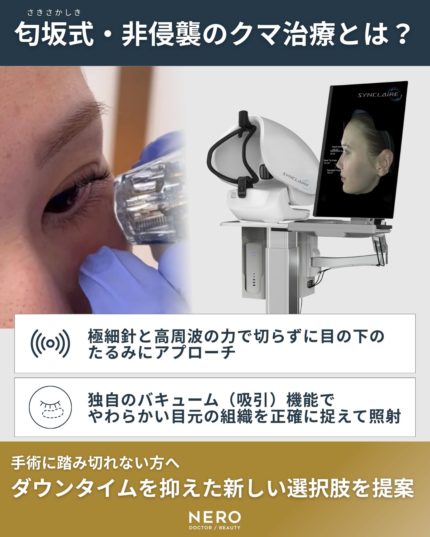 ニードルRFによる非侵襲的なクマ治療を紹介する図。極細針と高周波を用いて目の下のたるみにアプローチし、吸引機能で組織を安定させながら照射する施術シーン