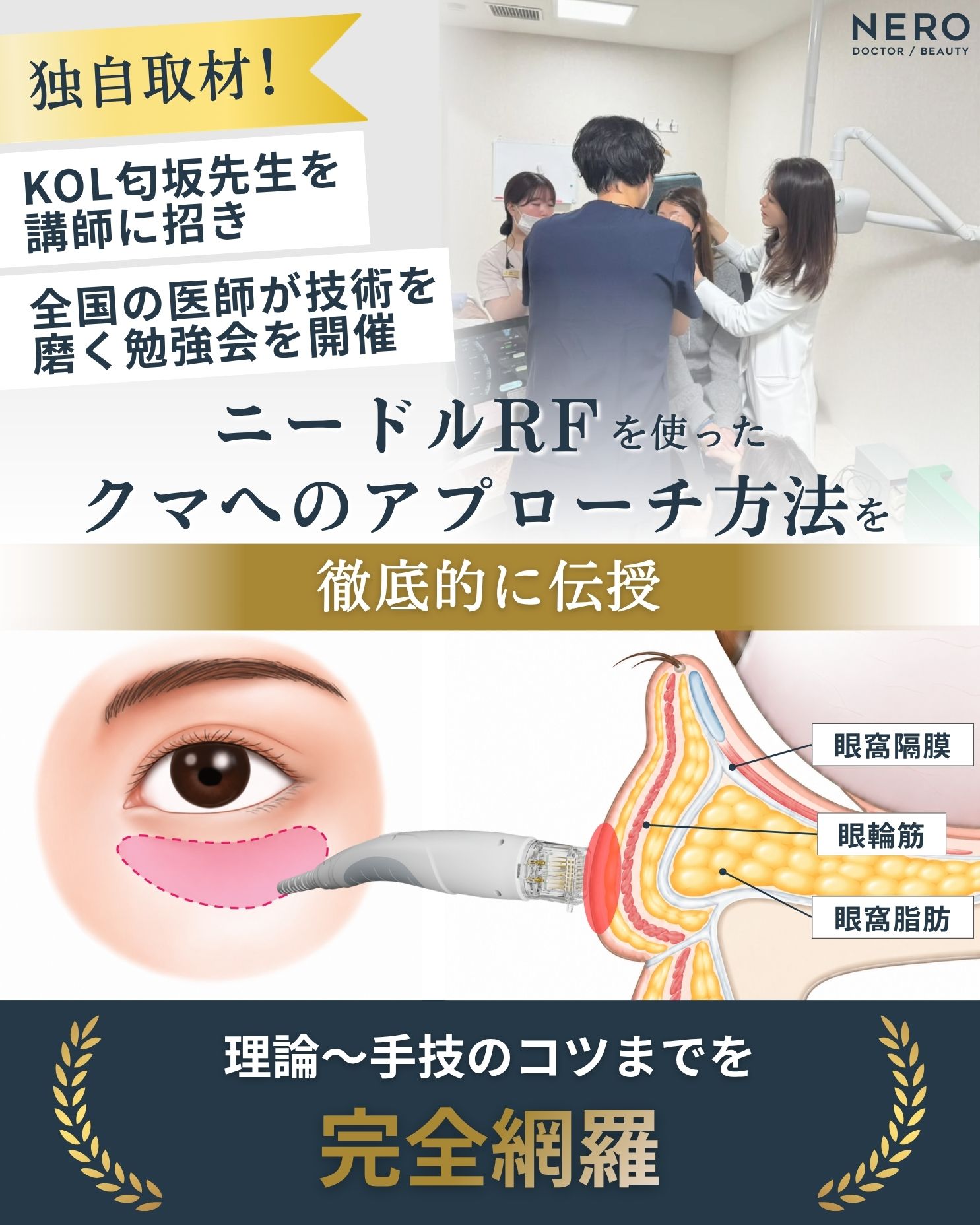 クマ治療におけるニードルRFの勉強会の様子と、目の下の解剖構造に対する照射イメージを示した図。眼窩隔膜や眼窩脂肪へのアプローチ方法を解説している