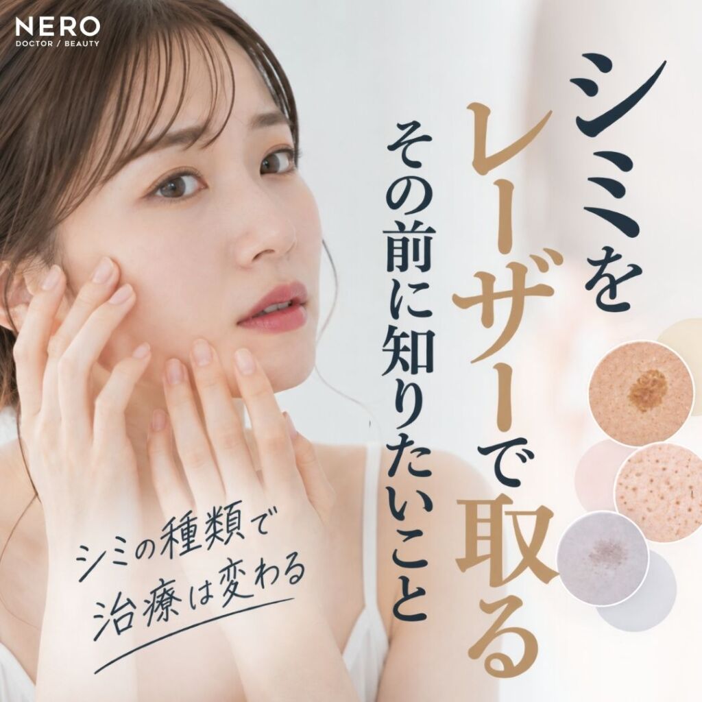 シミをレーザーで取る前に知りたい種類別の治療と注意点