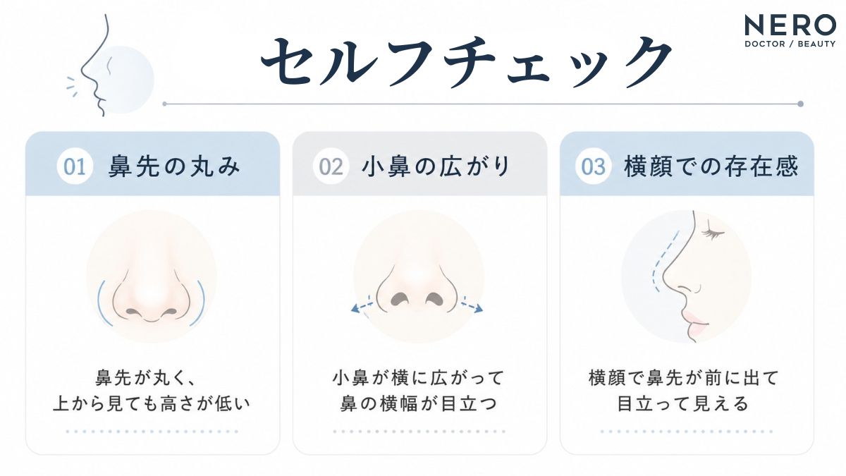 団子鼻がひどいかを確認するチェック項目をまとめた図