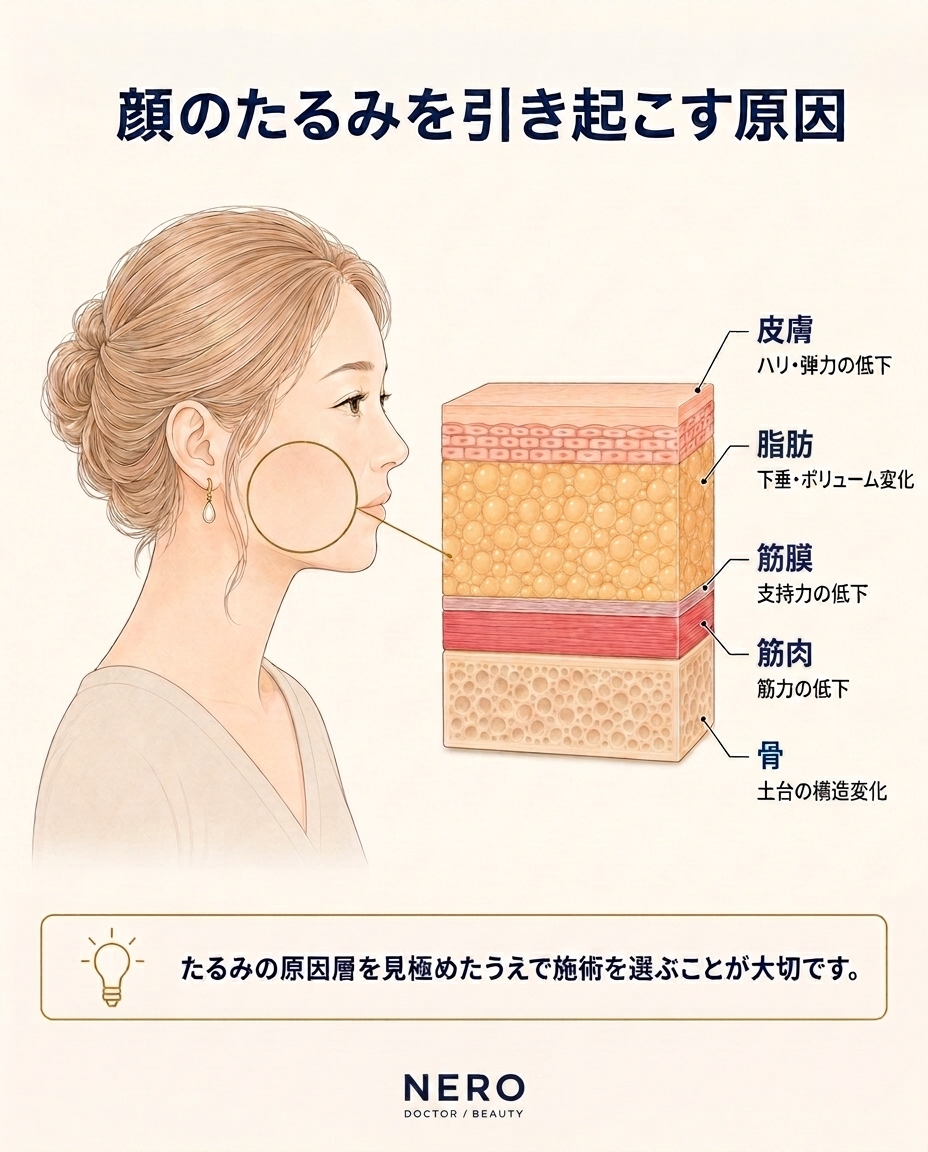 face-sagging-treatment-selection-flow