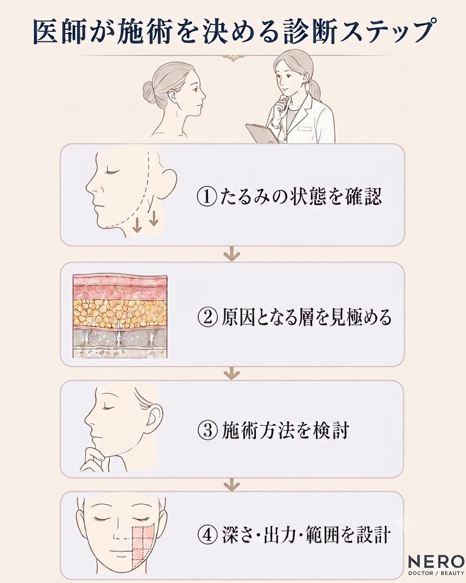 医師が施術をきめる診断ステップ