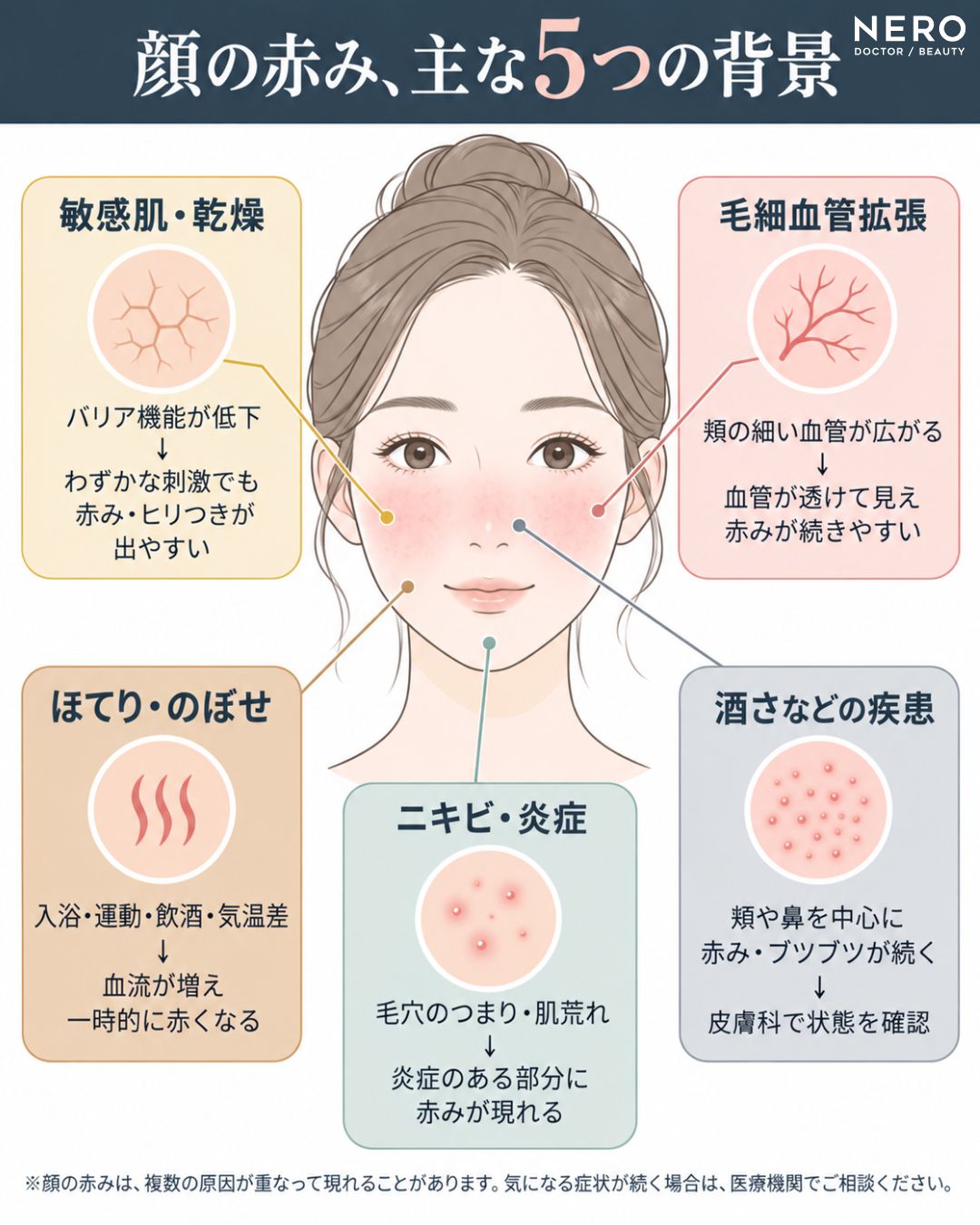 肌 赤み 原因