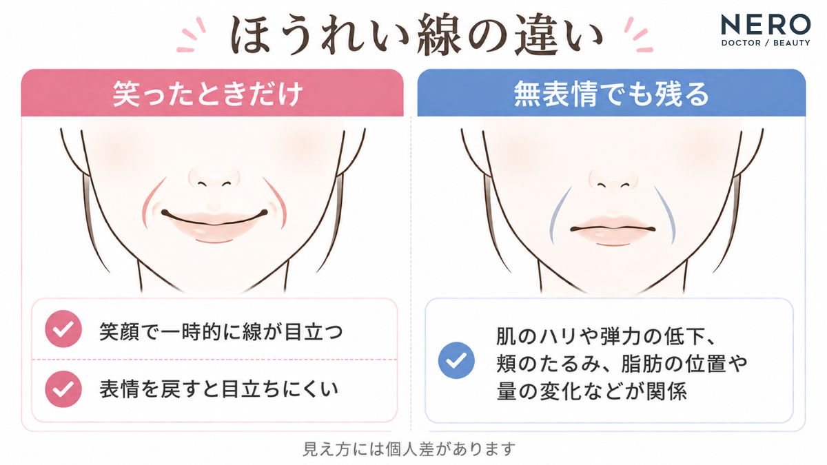 笑ったときと無表情のほうれい線の違いを比較した図