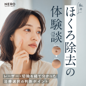 私がほくろを完全に消すまでの体験談～レーザー・切除を経て分かった治療選択の判断ポイント