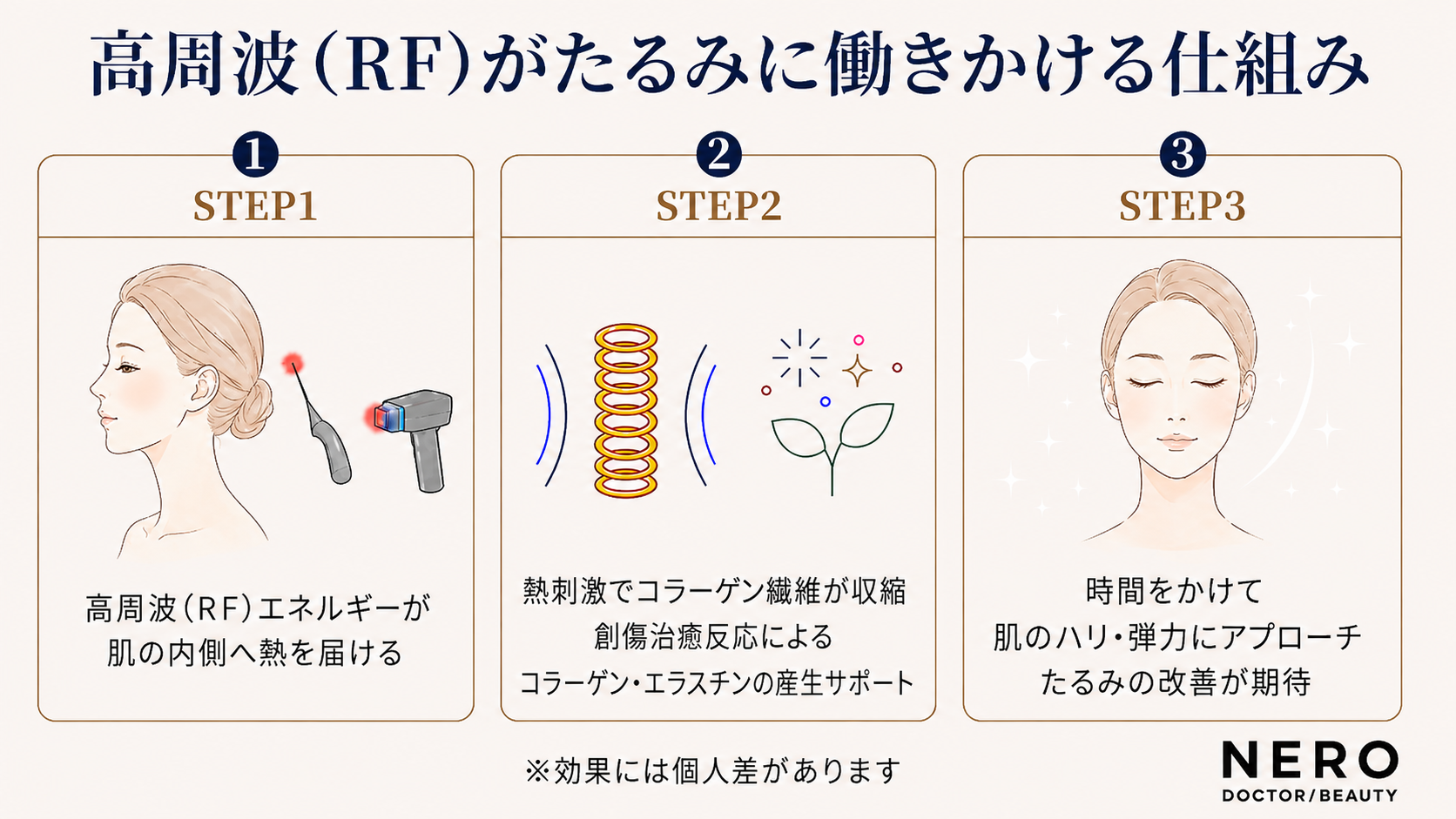 高周波(RF)がたるみ肌に働きかける仕組みを解説