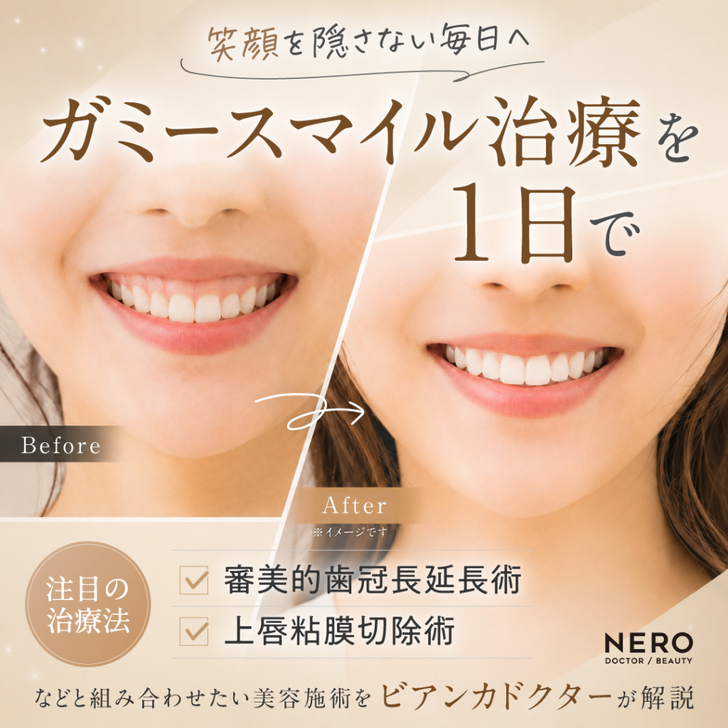 ガミースマイル治療を1日で｜注目の「審美的歯冠長延長術」や「上唇粘膜切除術」と組み合わせたい美容施術をビアンカドクターが解説