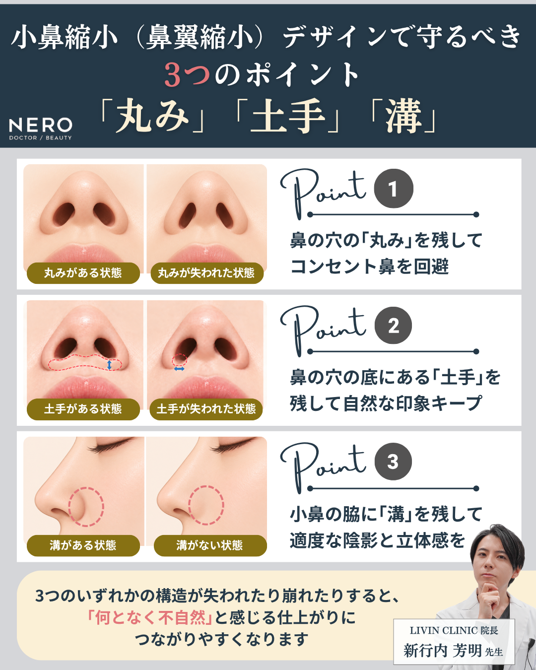 小鼻縮小(鼻翼縮小)デザインで大切な3つのポイント