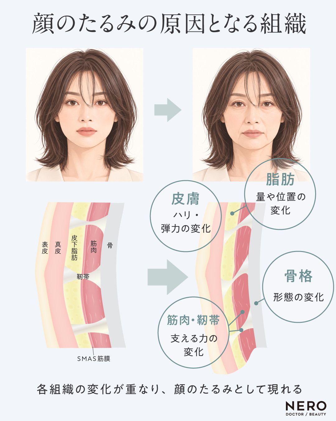 顔のたるみの原因となる組織の解説図