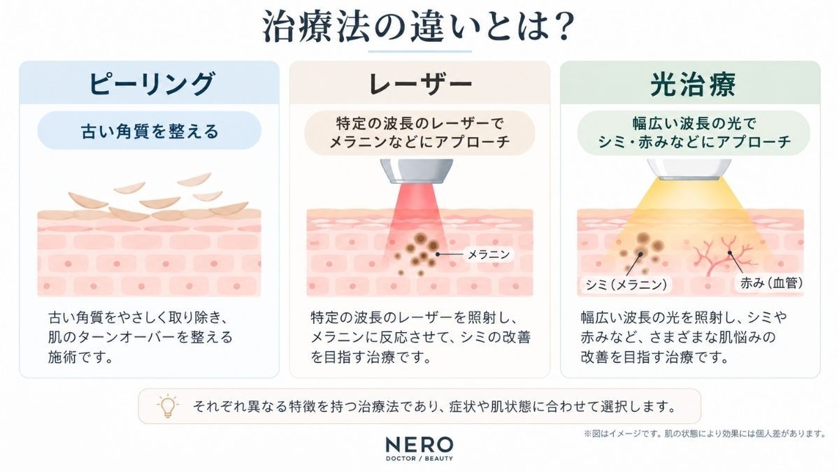 ピーリングとレーザー・光治療の作用の違いをまとめた比較図