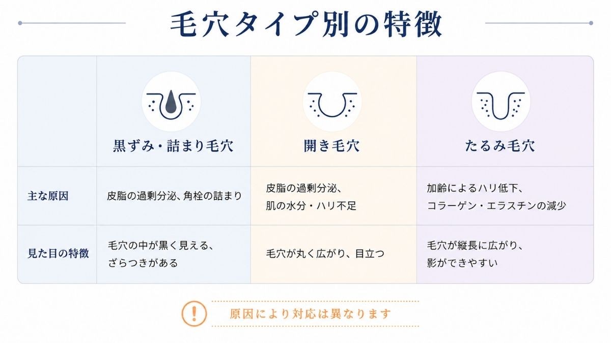 毛穴タイプ別にピーリングの考え方をまとめた比較表