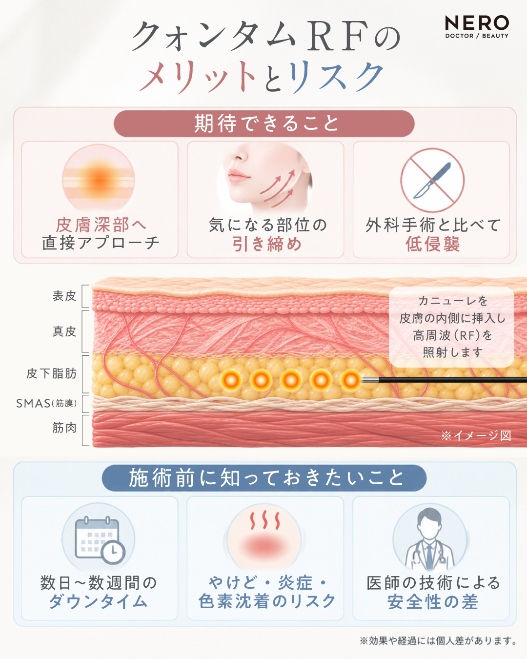 クォンタムRFのメリットとリスクを示した図