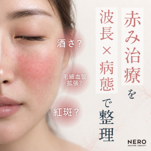 酒さ？毛細血管拡張？紅斑？赤み治療を“波長×病態”で整理する